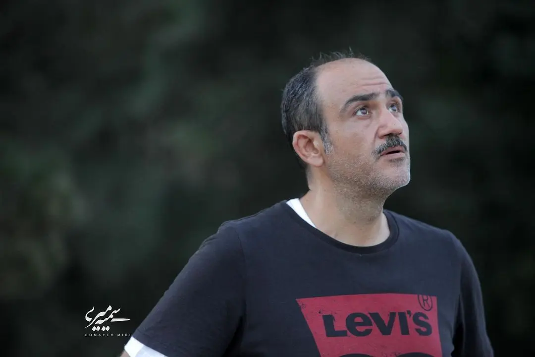 صورت مهران غفوریان سوخت | چهره عجیب مهران غفوریان همه را شوکه کرد مهران غفوریان