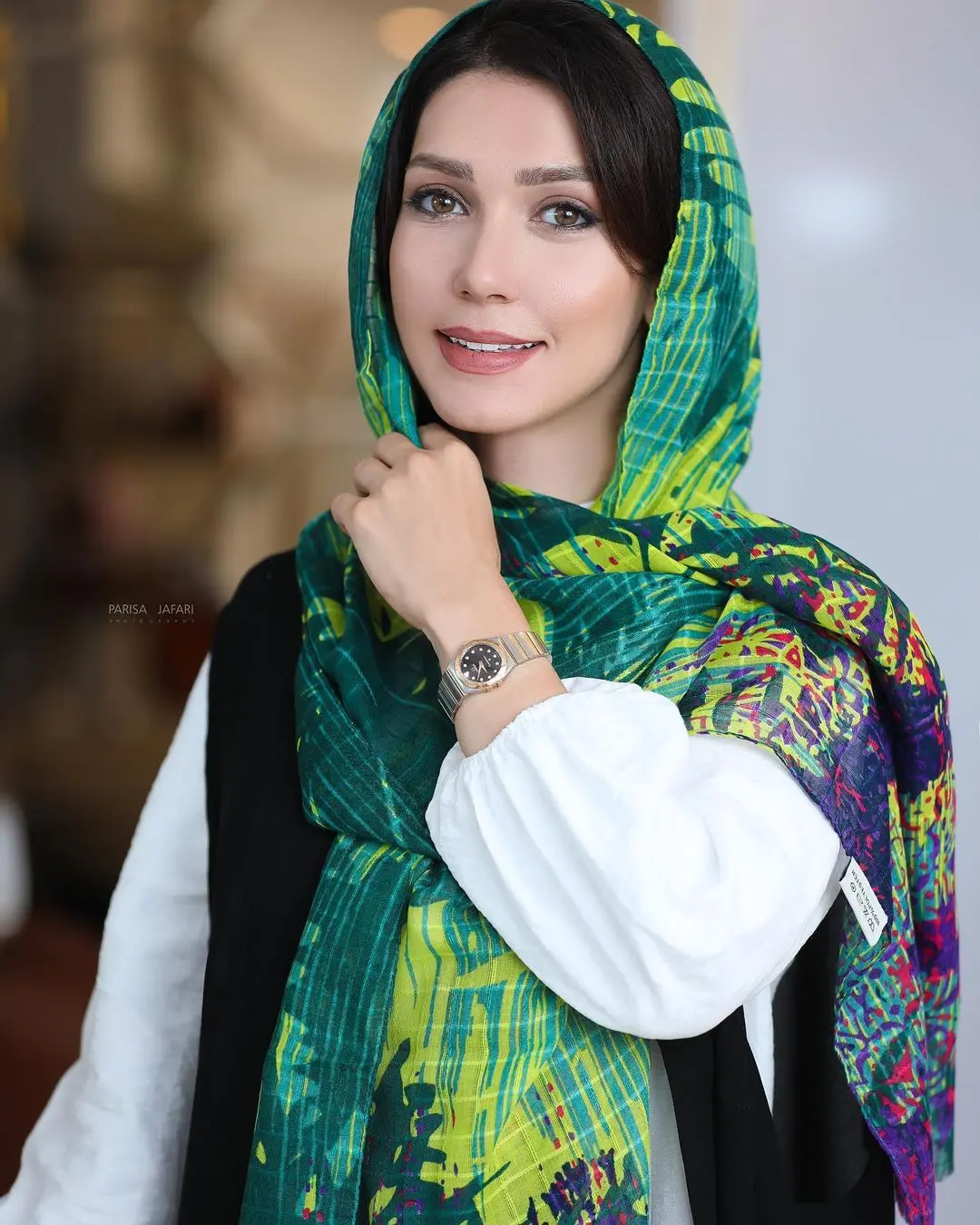 شهرزاد کمال زاده بلاگر شد | تغییر چهره شهرزاد کمال زاده پس از عمل زیبایی شهرزاد کمال زاده