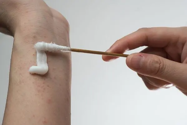 با حساسیت به طلا خداحافظی کنید 2