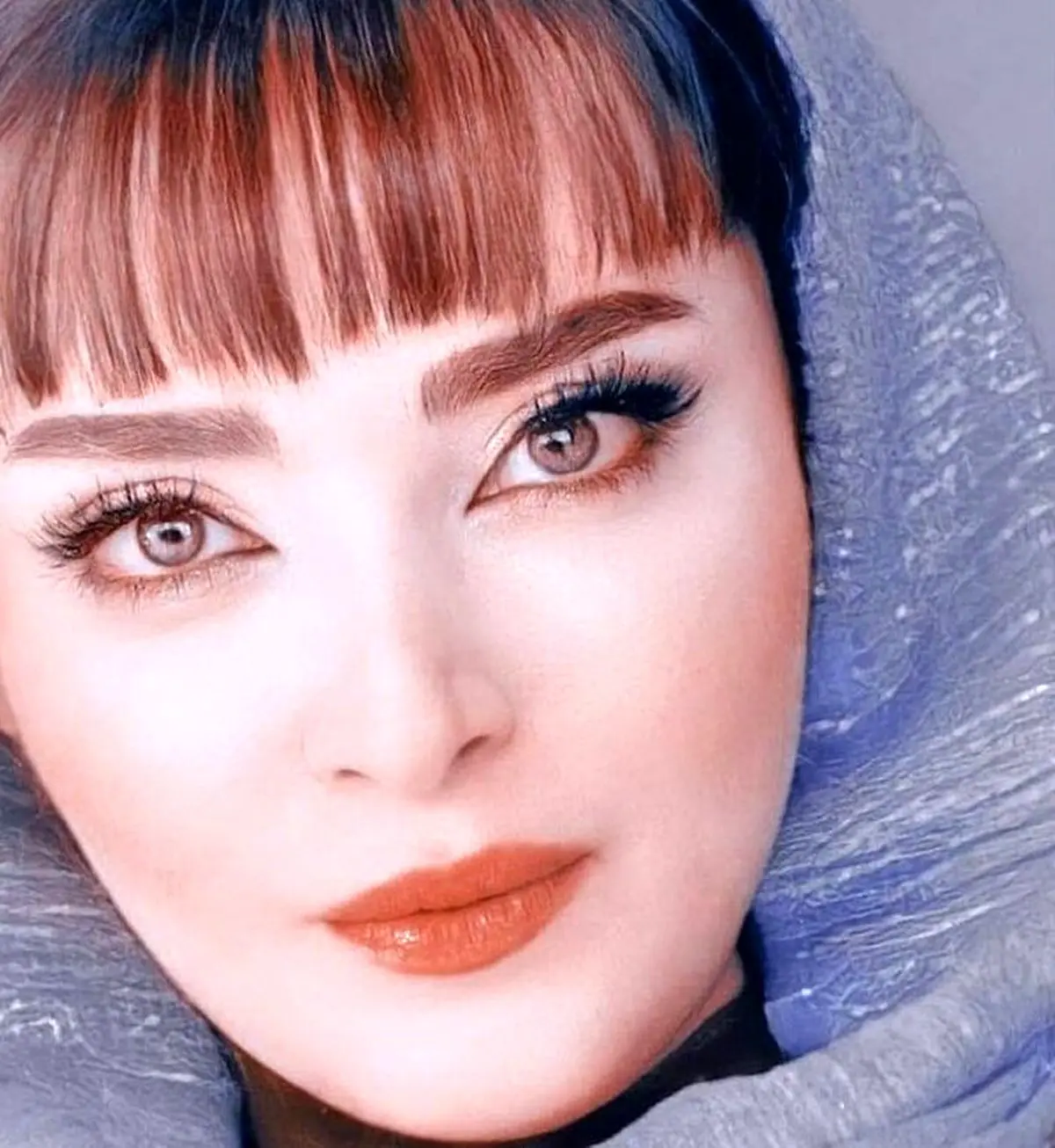 بهنوش طباطبایی تحت درمان قرار گرفت | بیماری بهنوش طباطبایی چیست ؟