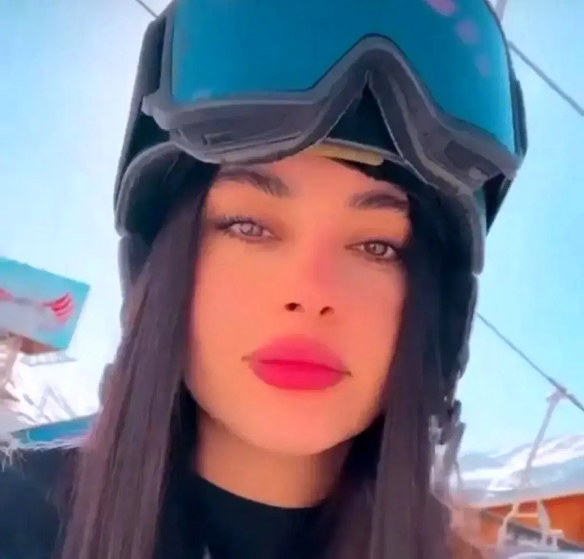 تصادف وحشتناک ترلان پروانه | ترلان پروانه راهی بیمارستان شد