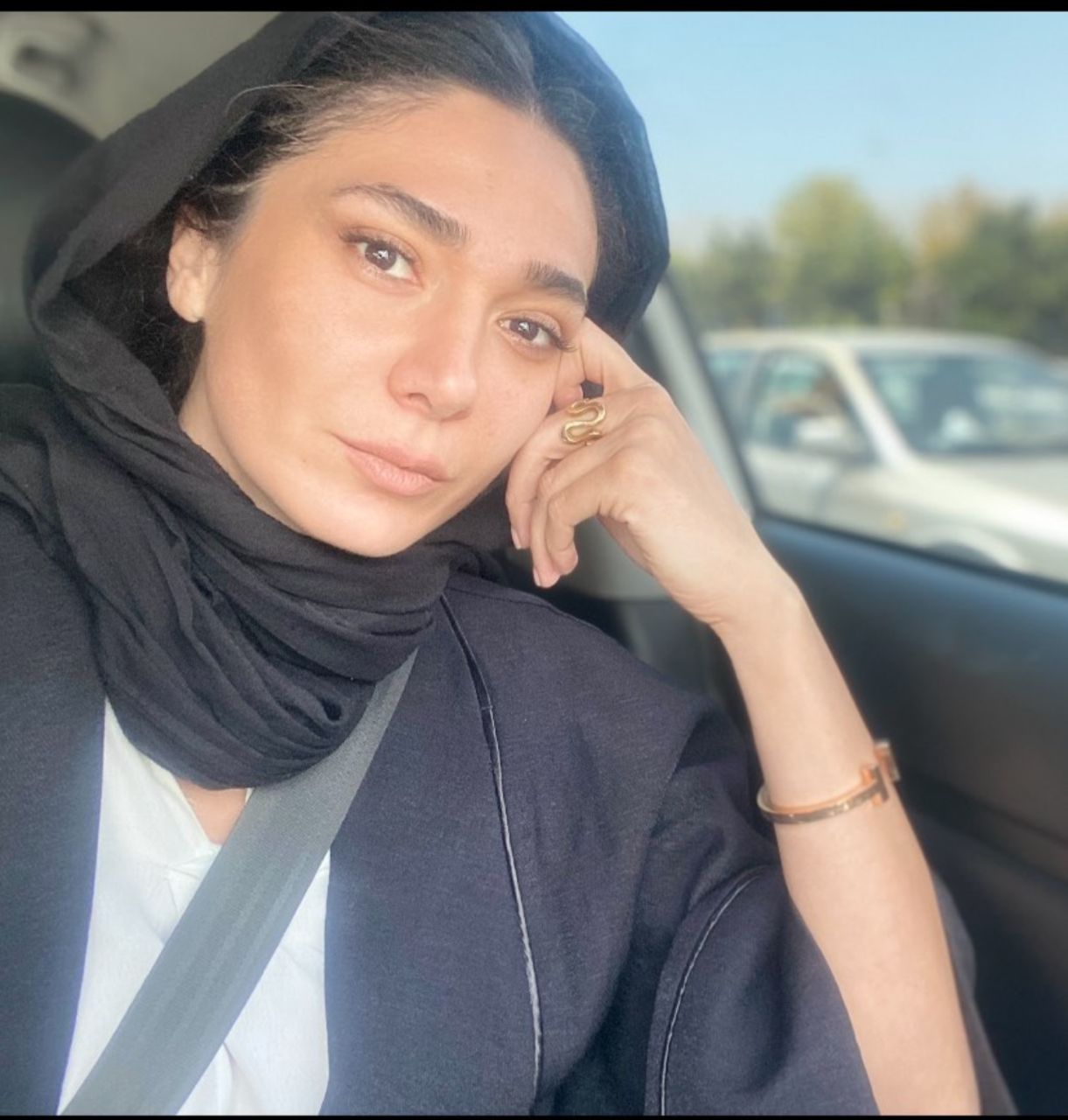 چهره وحشتناک مینا وحید | چه بلایی بر سر مینا وحید در ترکیه آمده است؟ مینا وحید