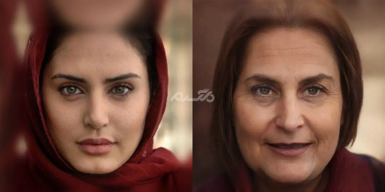 چهره زشت و داغون الناز شاکردوست بعد از جراحی زیبایی | الناز شاکردوست چه بلایی سر خودش آورد؟ الناز+شاکردوست