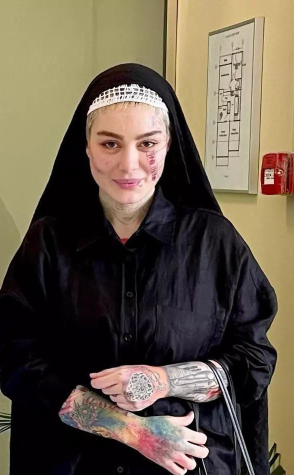 چهره داغون و شکسته سحر قریشی سحر قریشی