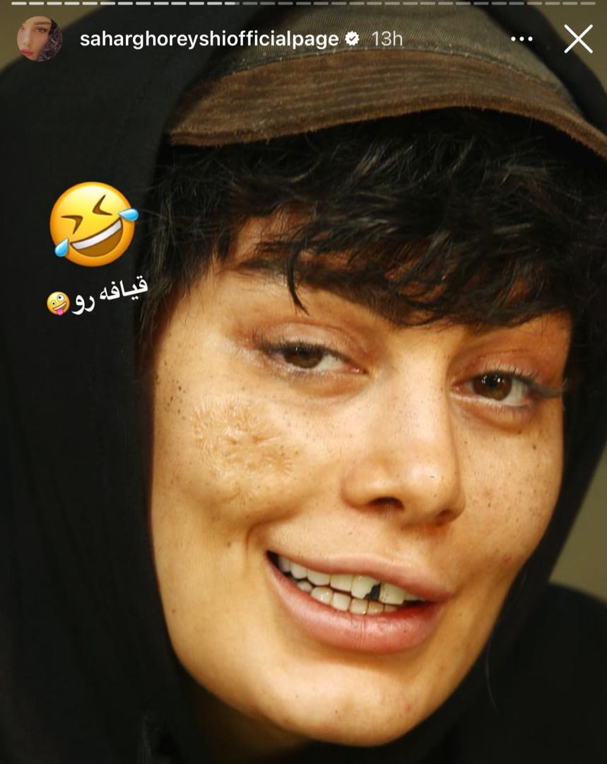 چهره داغون و شکسته سحر قریشی سحر قریشی