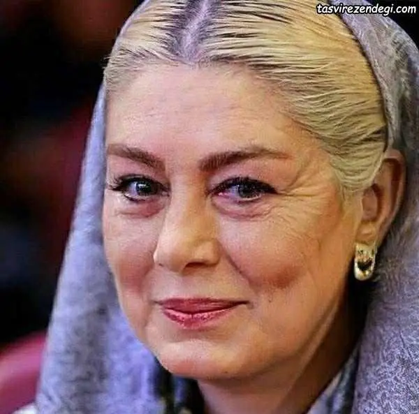 چهره داغون و شکسته سحر قریشی سحر قریشی