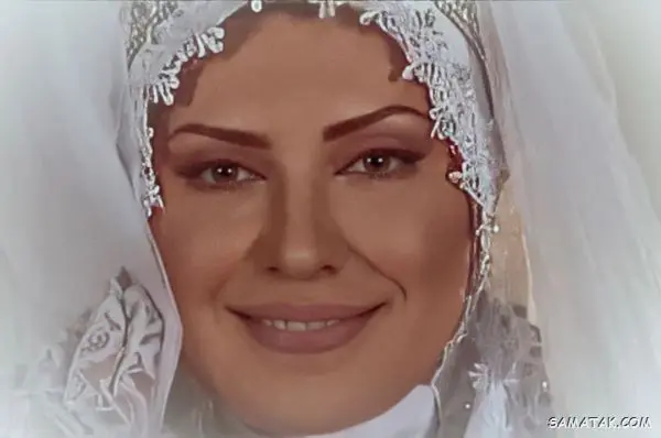 تصادف وحشتناک لعیا زنگنه در جاده شمال | چهره لعیا زنگنه داغون شد+عکس لعیا زنگنه