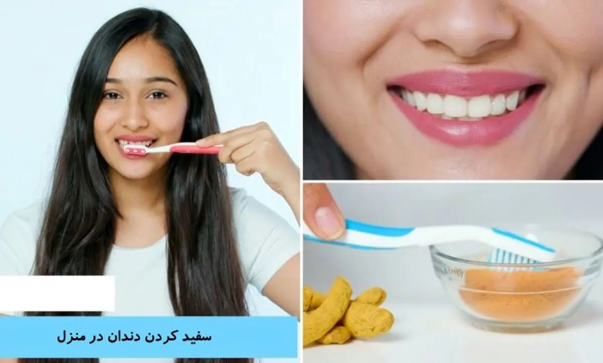 با این روش های آسون تا عید دندونات و سفید سفید کن با این روش های آسون تا عید دندونات و سفید سفید کن