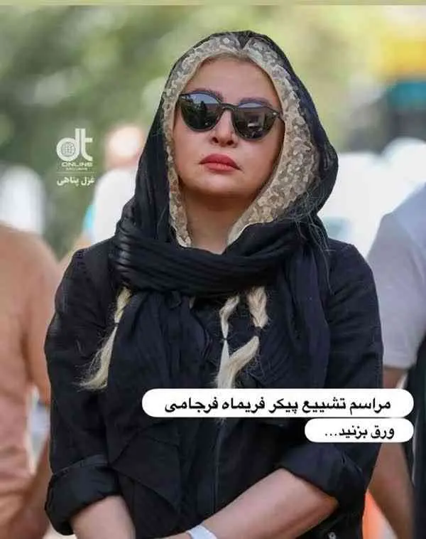 عکس جدید مه لقا باقری همه رو میخکوب کرد | اولین عکس مه لقا باقری بعد از جراحی زیباییش مه لقا باقری