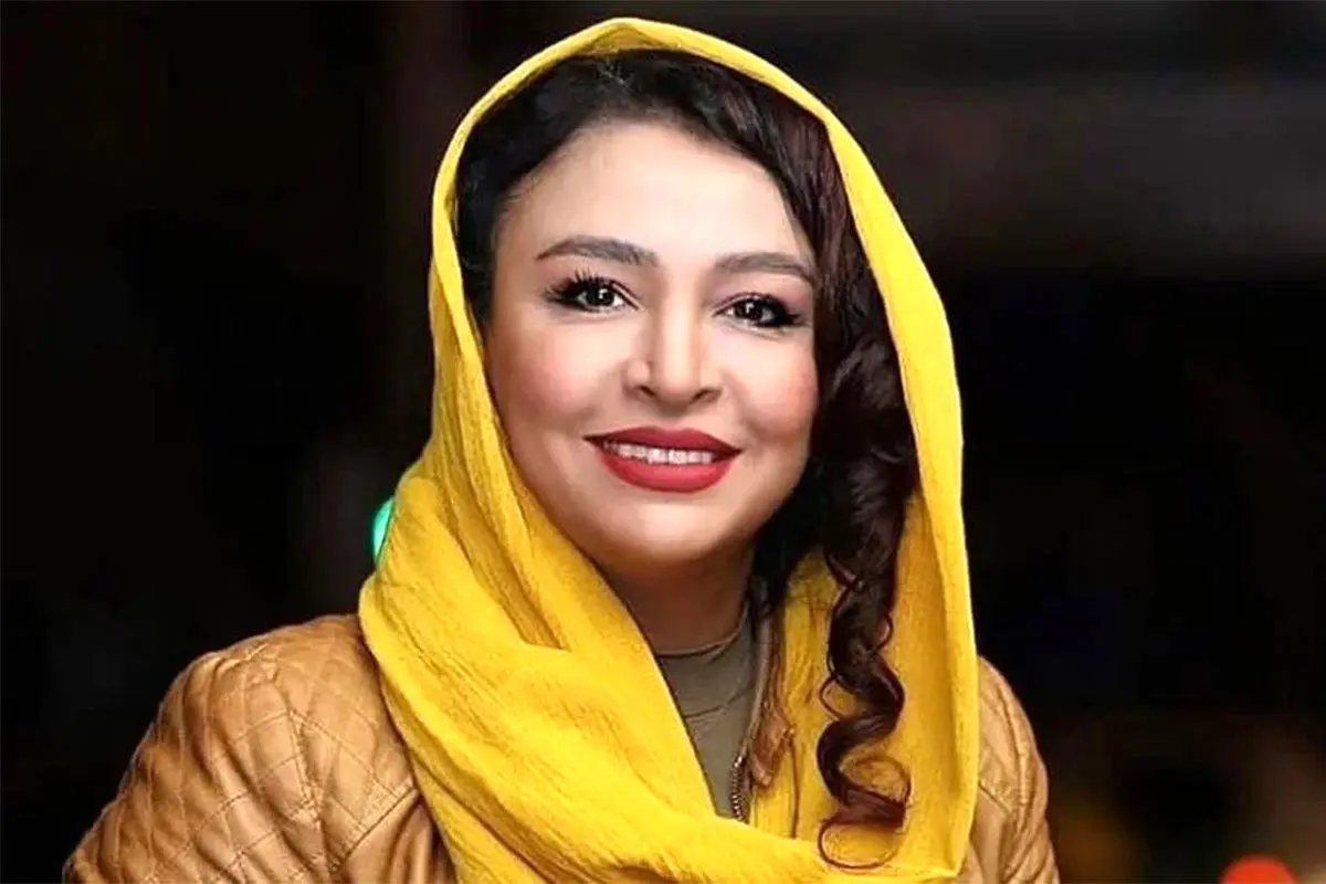 این بازیگر سریال زخم کاری رو شناختید؟ | خانم بازیگر چه تیپ و استایلی زده انگار 20 سالشه!