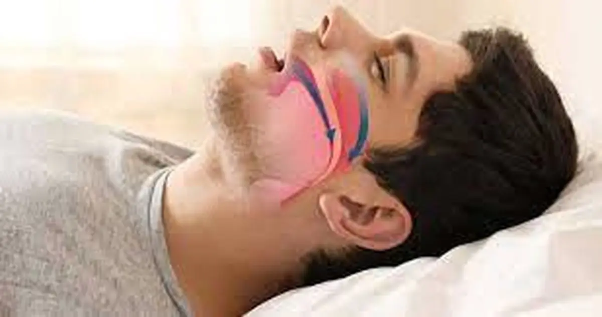 احتمال سکته قلبی با آپنه خواب افزایش می یابد | راه حل و درمان آپنه خواب + مطالعات احتمال سکته قلبی با آپنه خواب افزایش می یابد | راه حل و درمان آپنه خواب + مطالعات