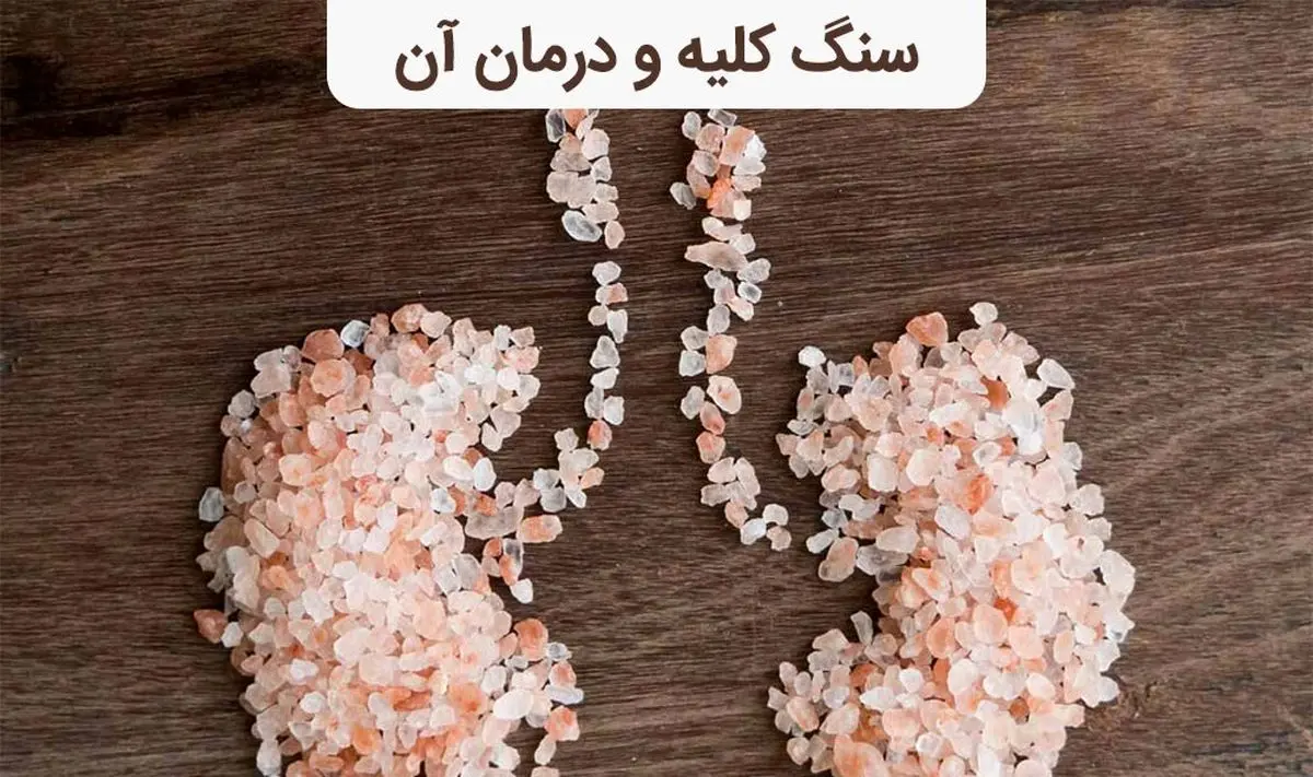عواملی که باعث ایجاد سنگ کلیه می شود | رعایت این چند نکته از سنگ کلیه جلوگیری می کند عواملی که باعث ایجاد سنگ کلیه می شود | رعایت این چند نکته از سنگ کلیه جلوگیری می کند