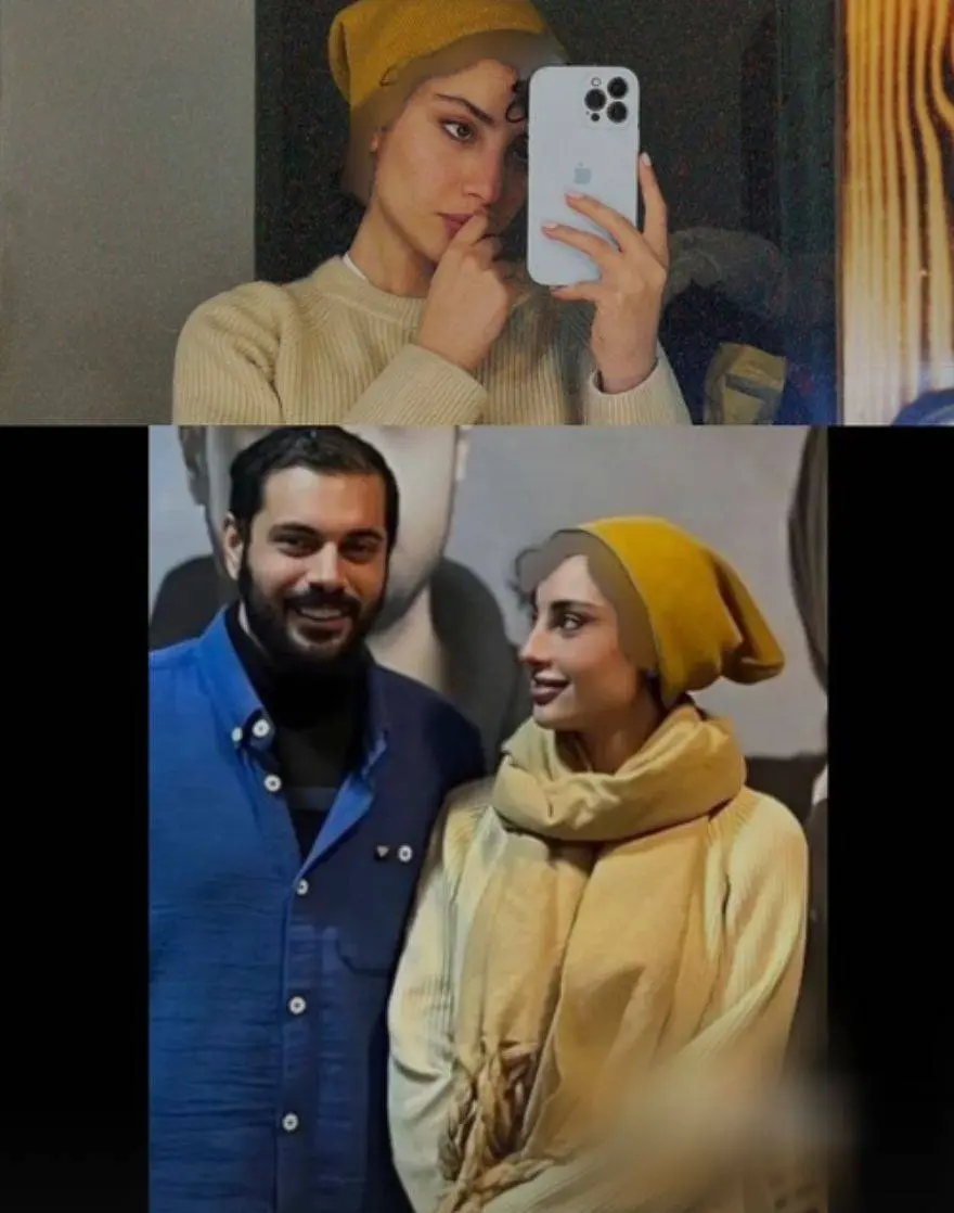 تغییر قیافه ترلان پروانه رو خودتون مقایسه کنید | ترلان پروانه چجوری دماغش رو عمل کرده که یه عمر رکب خوردیم! ترلان پروانه