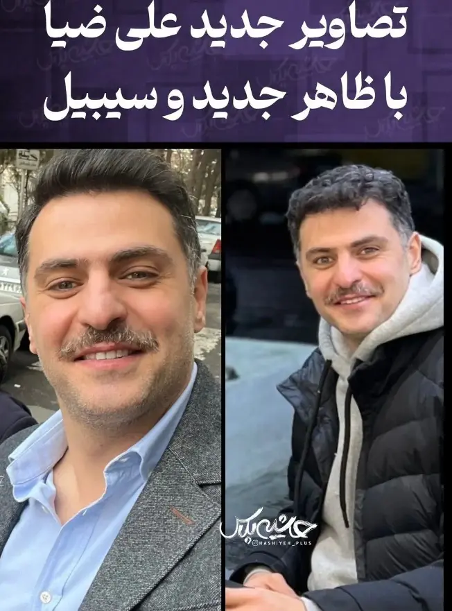علی ضیا هم دیگه پیر شد | مو های علی ضیا همه سفید شدند! علی ضیا