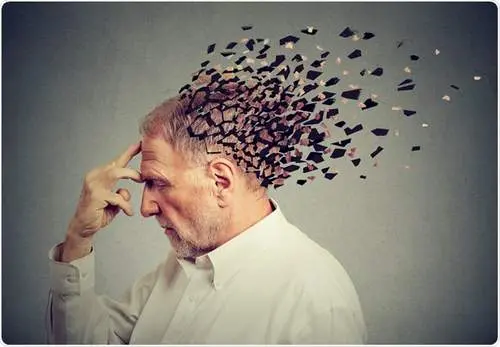 آلزایمر