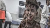 «حکم مرگ تدریجی» ۲۰۰ هزار مجروح غزه چگونه امضا میشود «حکم مرگ تدریجی» ۲۰۰ هزار مجروح غزه چگونه امضا میشود