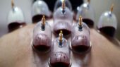 حجامت توسط افراد غیر متخصص خطرناک است